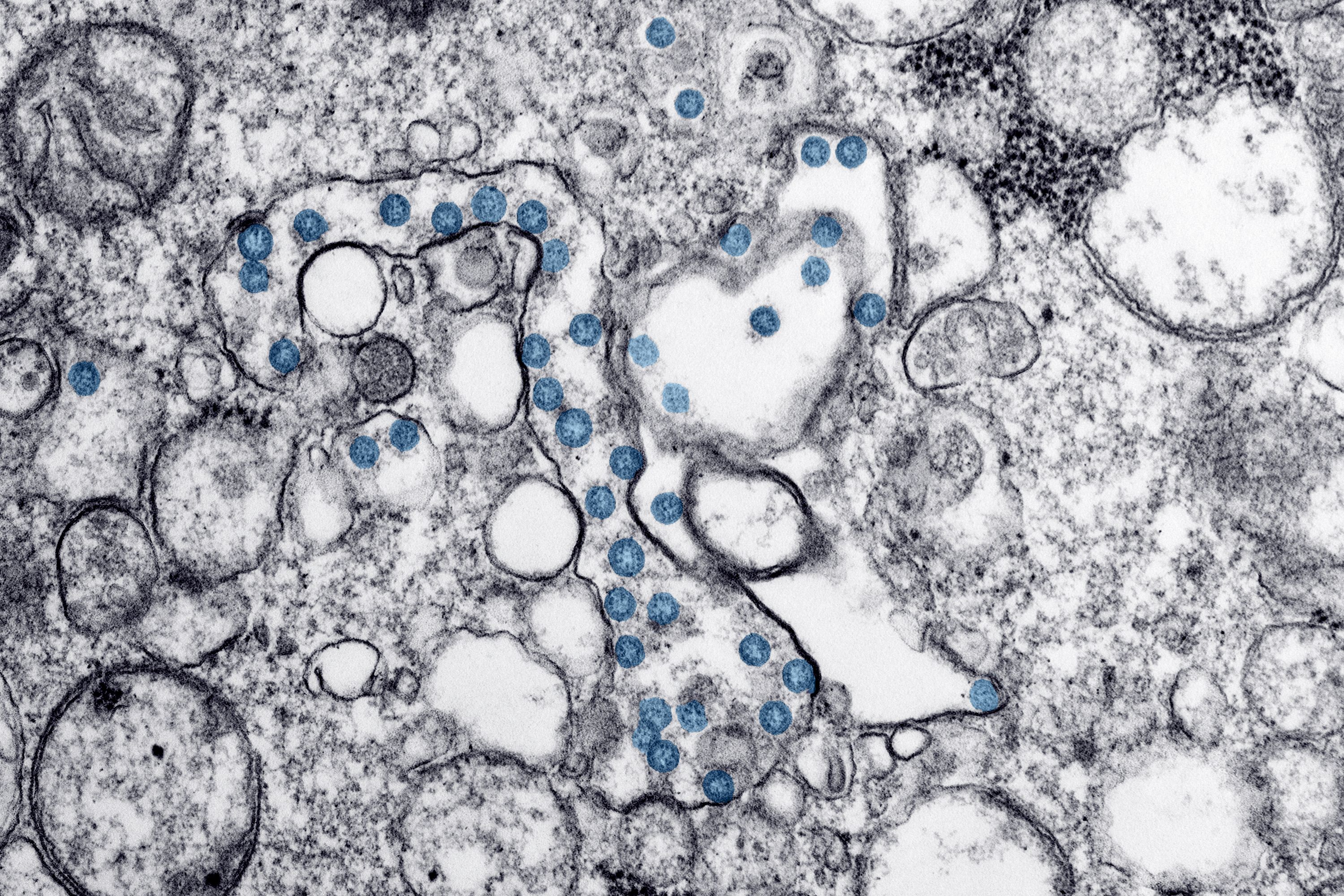 Transmission electron micrograph of virus particles within a cell, colourised